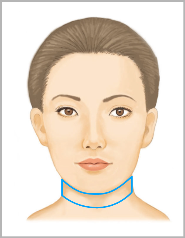 ボトックスリフト（あご・首リフトアップ）