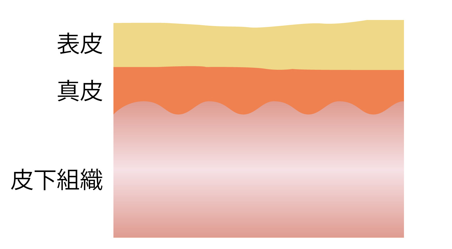 サブシジョン治療 After
