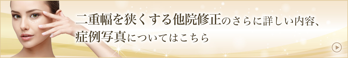 二重幅を狭くする他院修正