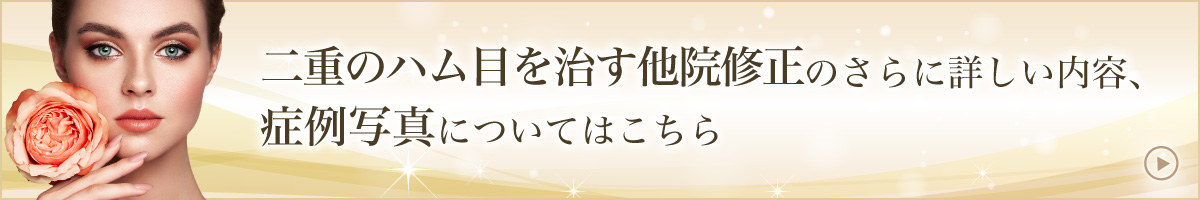 二重のハム目を治す他院修正